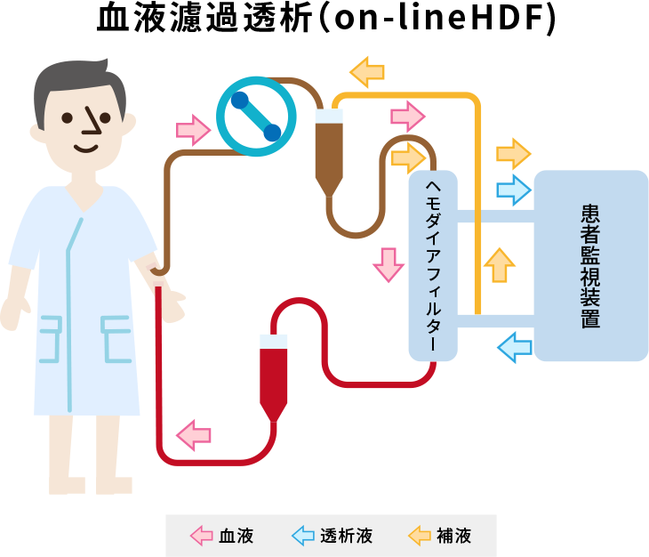 科學家改變沸石的特性以改善血液透析-國投盛世
